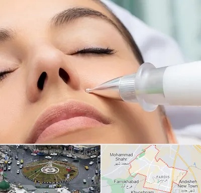پلاسما جت بینی در فردیس کرج 