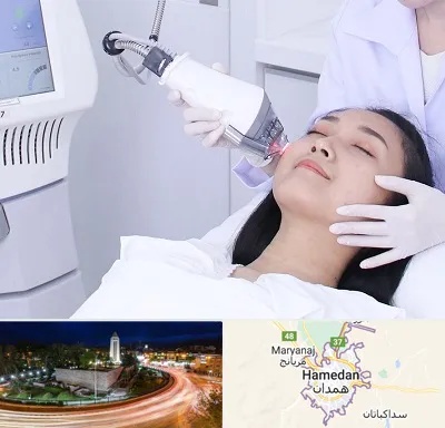 وایتنینگ در همدان