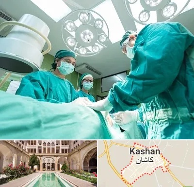 عمل تخلیه سینه در کاشان