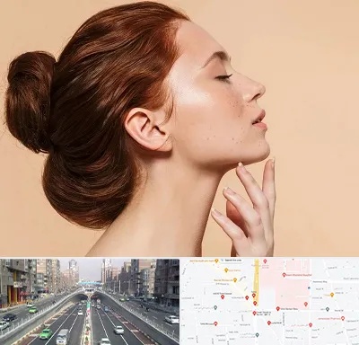 جراحی غبغب در توحید 