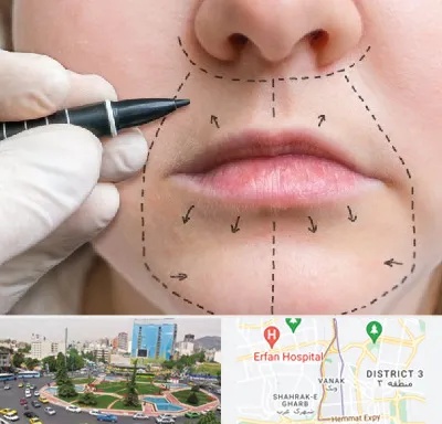 عمل سانترال لب در ونک 