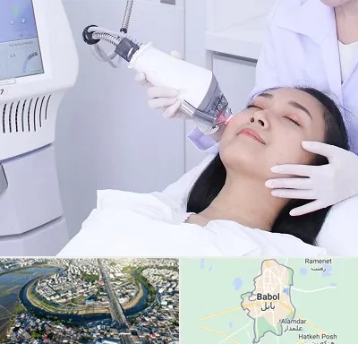 وایتنینگ در بابل