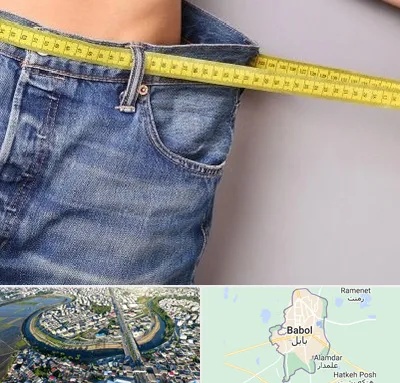 عمل لیپوماتیک در بابل