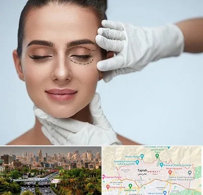 عمل پف چشم در منطقه 1 تهران 