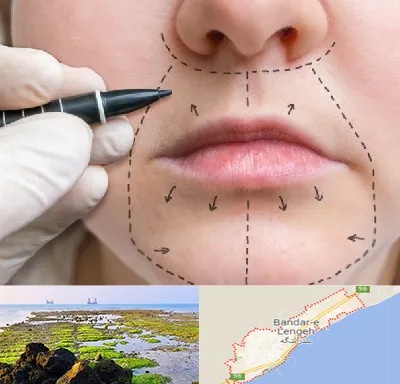 عمل سانترال لب در بندرلنگه