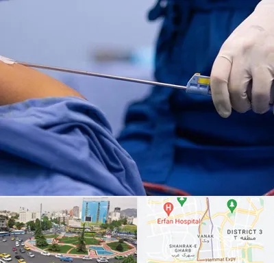 پیکر تراشی در ونک 