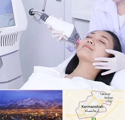 وایتنینگ در کرمانشاه