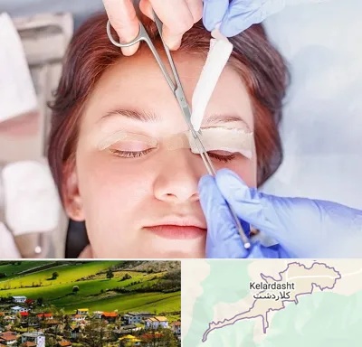 جراحی پلک افتاده در کلاردشت
