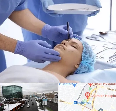 عمل بینی طبیعی در اقدسیه 