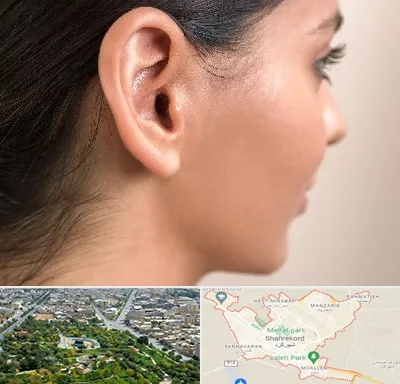 عمل گوش بل در شهرکرد