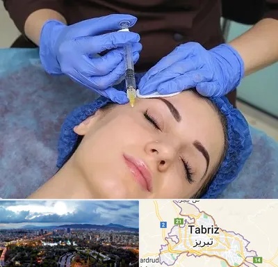 تزریق پروفایلو در تبریز