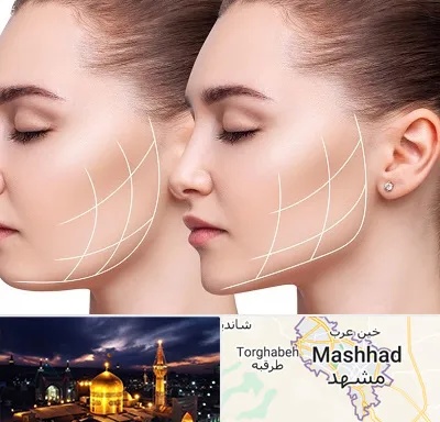 جراحی بوکال فت در مشهد