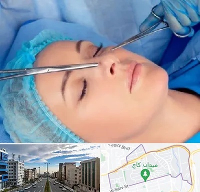 عمل بینی نیمه فانتزی در سعادت آباد 