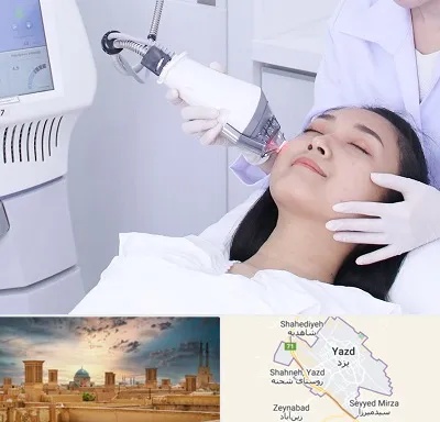 وایتنینگ در یزد