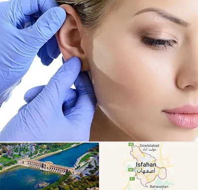 اتوپلاستی در اصفهان