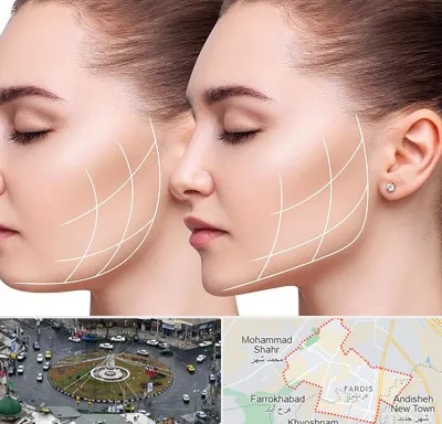 جراحی بوکال فت در فردیس کرج 