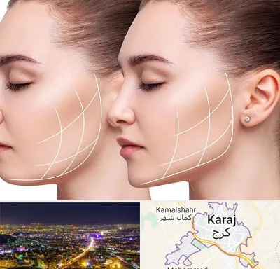 جراحی بوکال فت در کرج