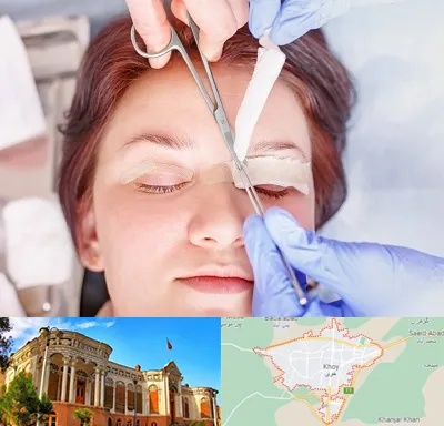جراحی پلک افتاده در خوی