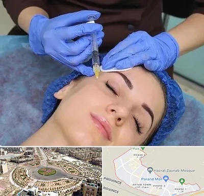 تزریق پروفایلو در پرند