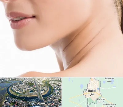 جراحی فک با لیزر در بابل