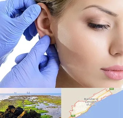 اتوپلاستی در بندرلنگه