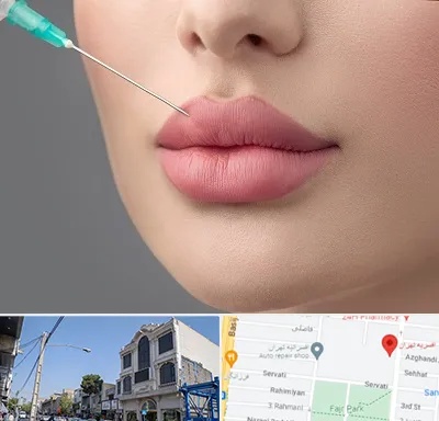 کلینیک ژل لب روسی در افسریه 