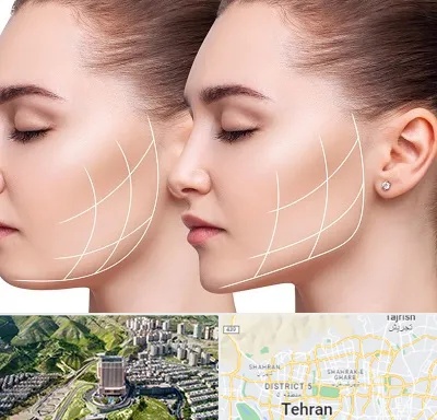 جراحی بوکال فت در شمال تهران 