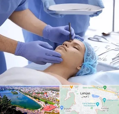 عمل بینی طبیعی در لاهیجان