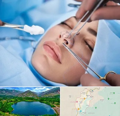عمل ترمیمی بینی در رودبار