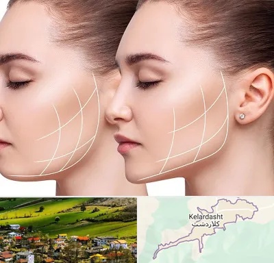 جراحی بوکال فت در کلاردشت