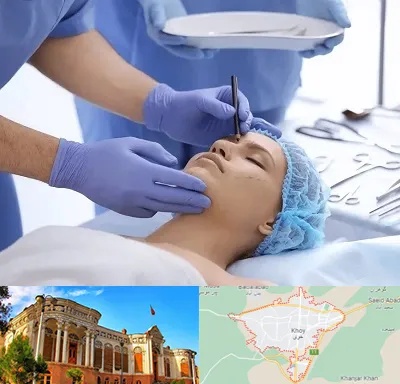 عمل بینی طبیعی در خوی