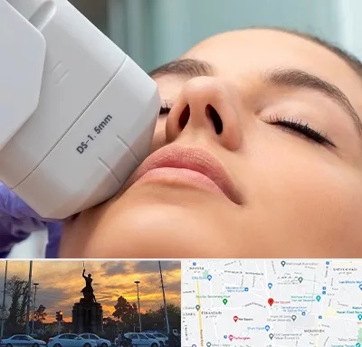 هایفوتراپی در میدان حر 