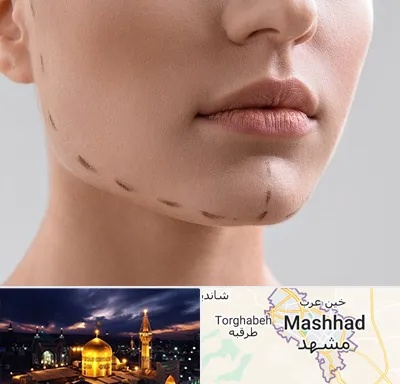 عمل زاویه فک در مشهد