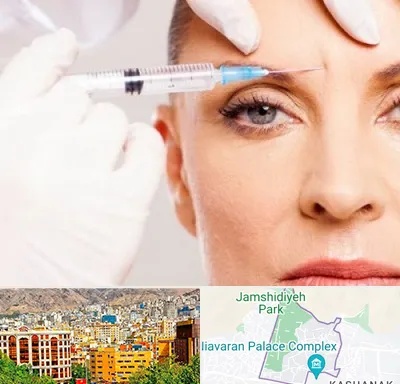 مزوژل در نیاوران 