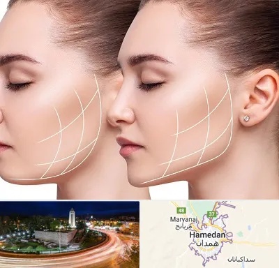 جراحی بوکال فت در همدان