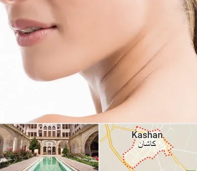 جراحی فک با لیزر در کاشان