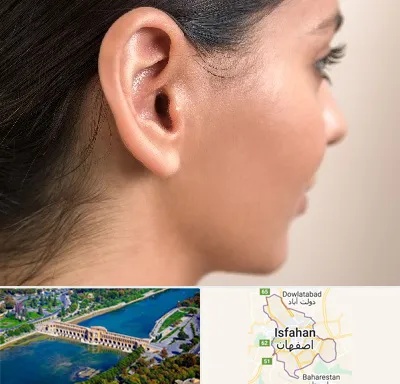 عمل گوش بل در اصفهان