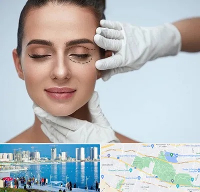 عمل پف چشم در چیتگر 