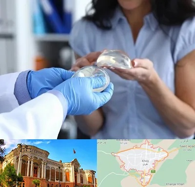 پروتز باسن در خوی