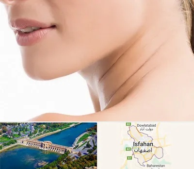 جراحی فک با لیزر در اصفهان