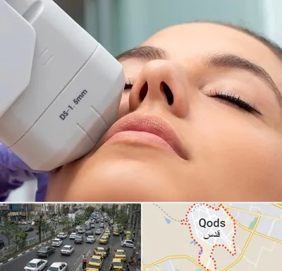هایفوتراپی در شهر قدس