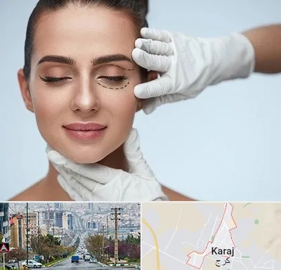 عمل پف چشم در گوهردشت کرج 