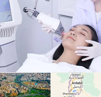 وایتنینگ در اردبیل