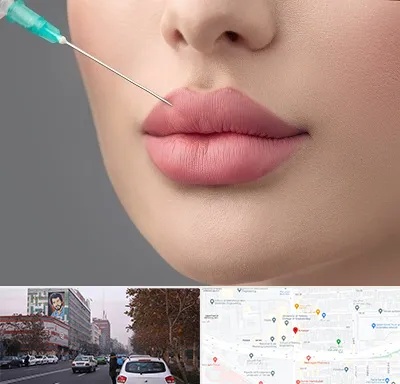 کلینیک ژل لب روسی در کارگر شمالی 