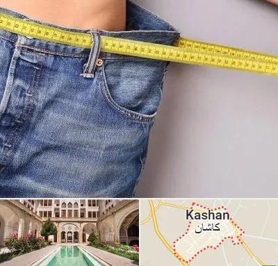 عمل لیپوماتیک در کاشان
