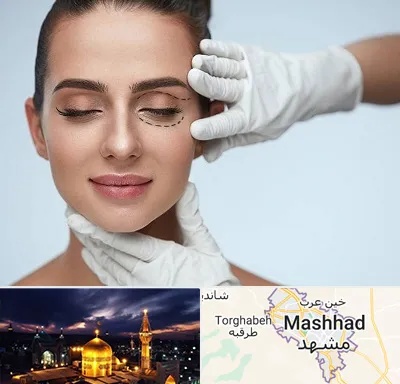 عمل پف چشم در مشهد
