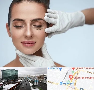 عمل پف چشم در اقدسیه 