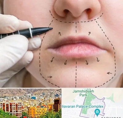 عمل سانترال لب در نیاوران 