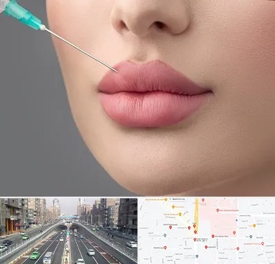 کلینیک ژل لب روسی در توحید 
