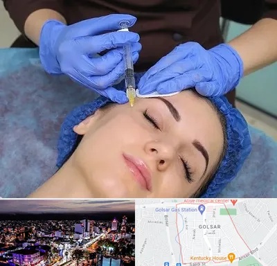 تزریق پروفایلو در گلسار رشت 